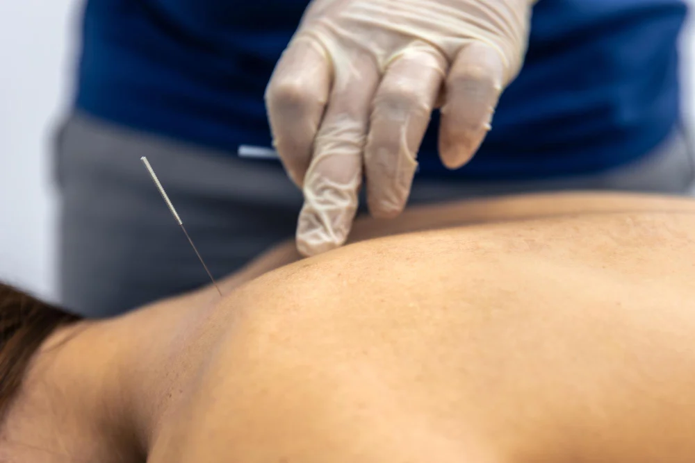Physiotherapy